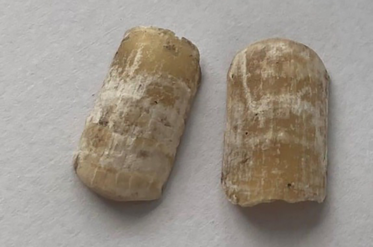 tham-an-1-9148-1685154412 Móng tay giả ở bàn tay của nạn nhân. Ảnh: Yên Khánh