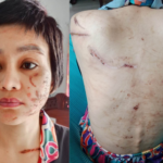 Chị Giao chi chít vết thương trên người. Ảnh: Gia đình cung cấp