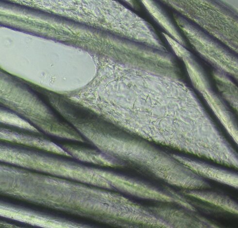 Bó sợi polymer sinh học của dây chằng nhân tạo được thử nghiệm hoạt tính sinh học trên tế bào mô sợi trong ống nghiệm sau 10 ngày, cho thấy có sự bám dính và phát triển của cụm tế bào rõ rệt. Ảnh: Nhóm nghiên cứu