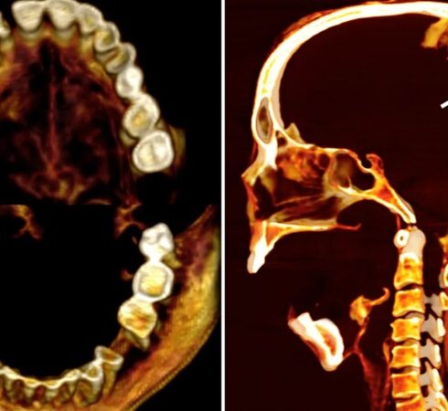 Ảnh chụp cắt cắt lớp khuôn miệng há to của Người phụ nữ hét. Ảnh: Sahar Saleem