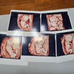 Siêu âm 5 con đầu lòng của vợ chồng Kim và Sagong. Ảnh: Yonhap