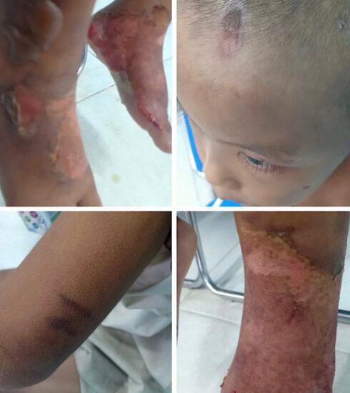 Bé trai mang nhiều vết thương khi được người dân phát hiện. Ảnh: Mẹ bé cung cấp