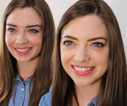 Người song trùng có vẻ ngoài giống hệt nhau dù không có quan hệ ruột thịt. Ảnh: ABC News